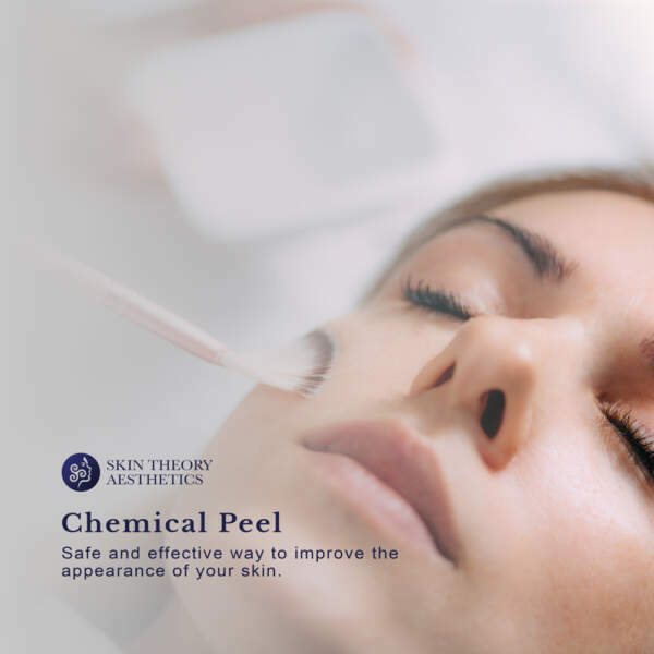 Chemical-Peel