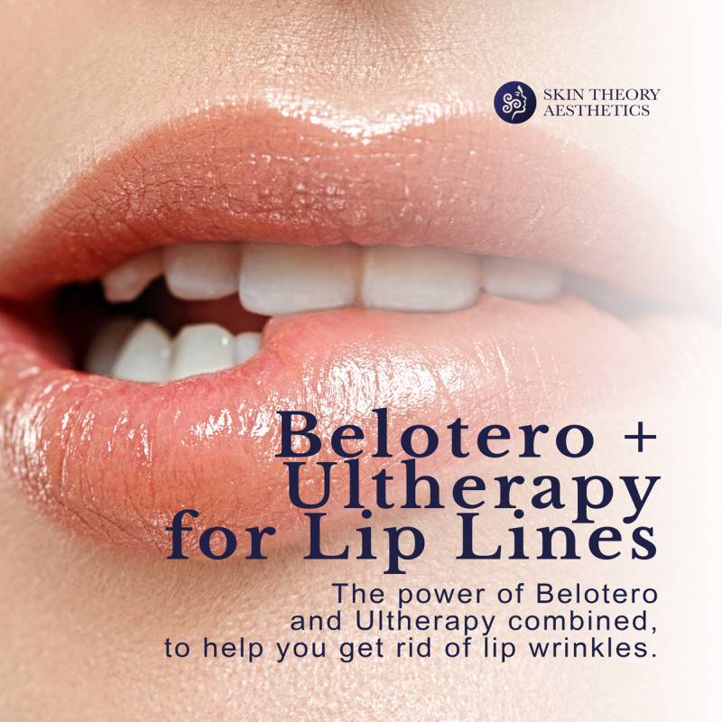 Skin-Theory-Belotero-Ultherapy