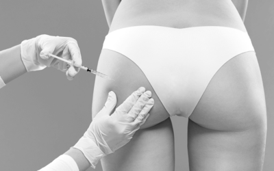 Non-Surgical Buttocks Lift