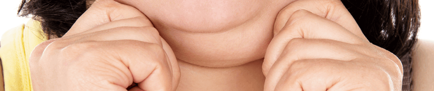 All About Kybella