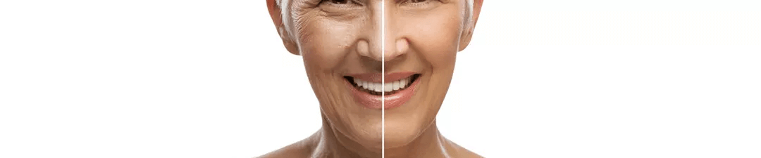 Skin Rejuvenation