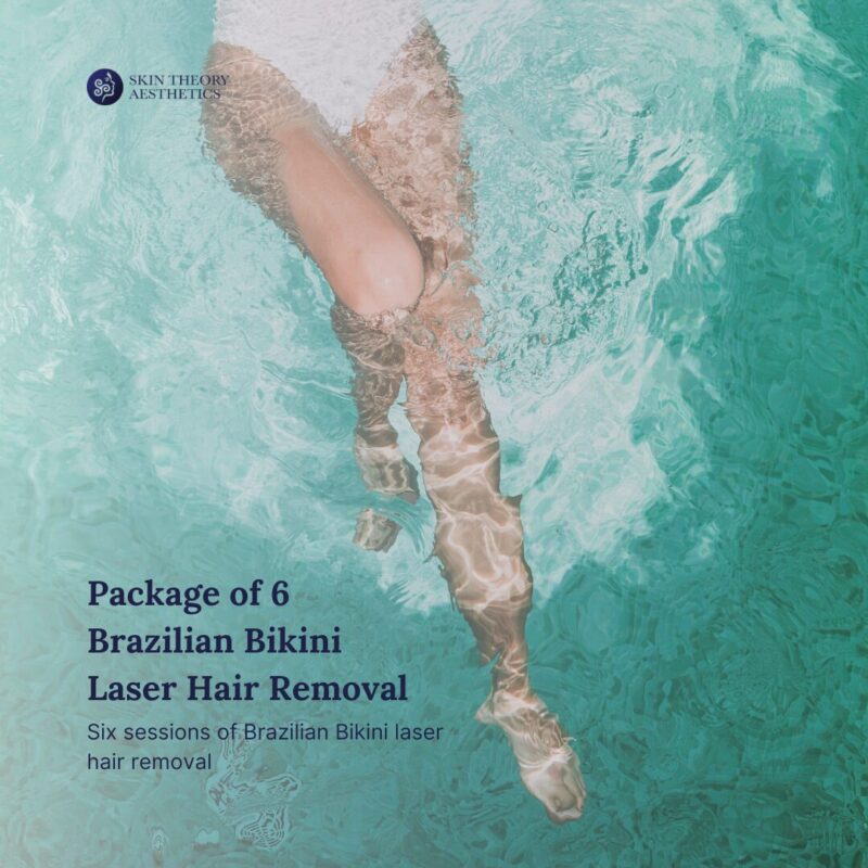 Package of 6 Brazilian Bikini Laser Hair Removal